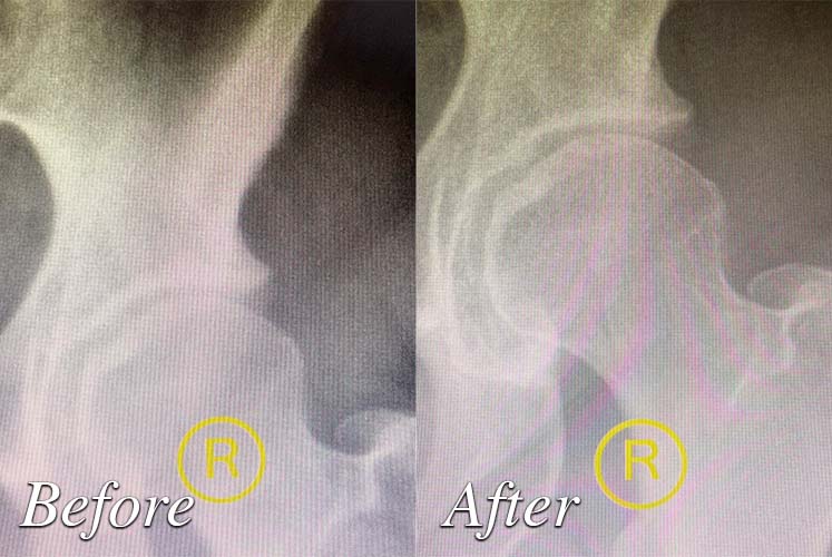 Photo of Before and after treatment by Granite Bay Advanced Joint Pain Relief Solutions