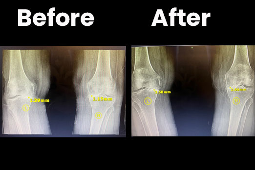 Chiropractor Dr. Neil K Hersh, M.D.