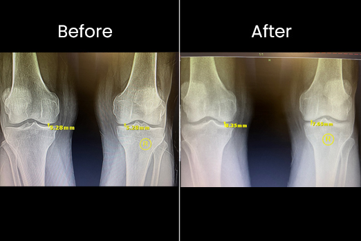 Chiropractor Dr. Neil K Hersh, M.D.