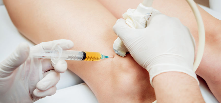 Patient receiving PRP injection to relieve knee pain